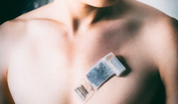 Носимые ультразвуковые сенсоры совершат революцию в мониторинге здоровья