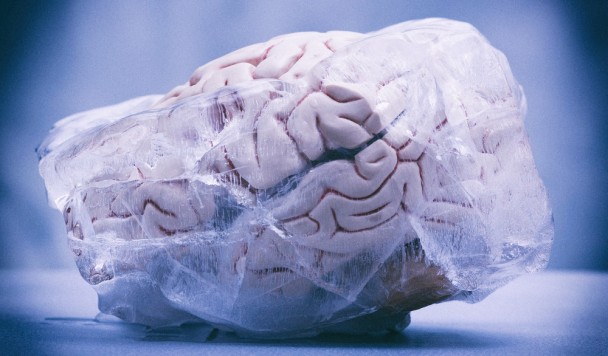 Новая технология позволяет без повреждений замораживать человеческий мозг