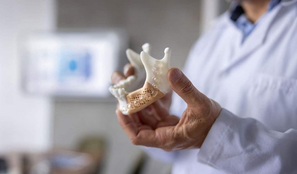 Учёные создали биостекло для 3D-печати костных имплантатов