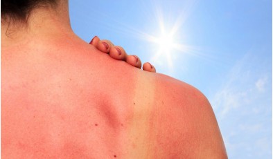 Сенсор для кожи предупреждает пользователя о риске обгореть на солнце