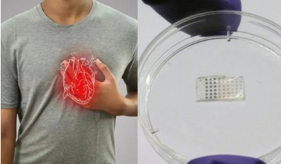 Пластырь для сердца: новая разработка MIT помогает восстановиться после инфаркта