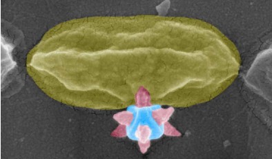Создана поверхность, которая убивает бактерии, буквально прокалывая их шипами