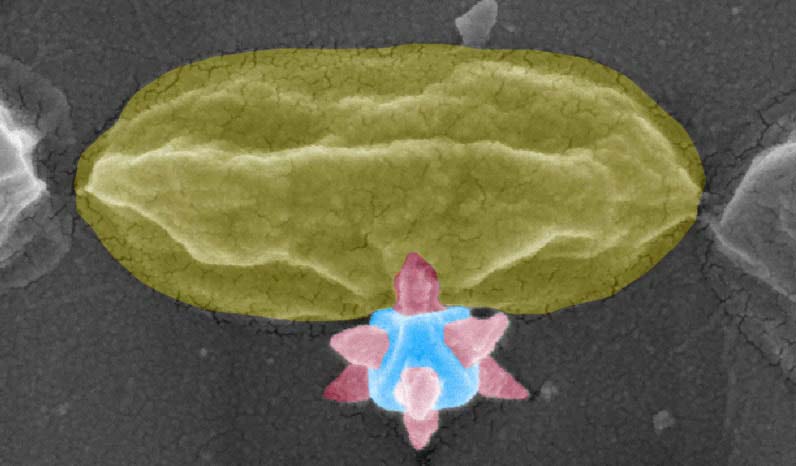 Создана поверхность, которая убивает бактерии, буквально прокалывая их шипами