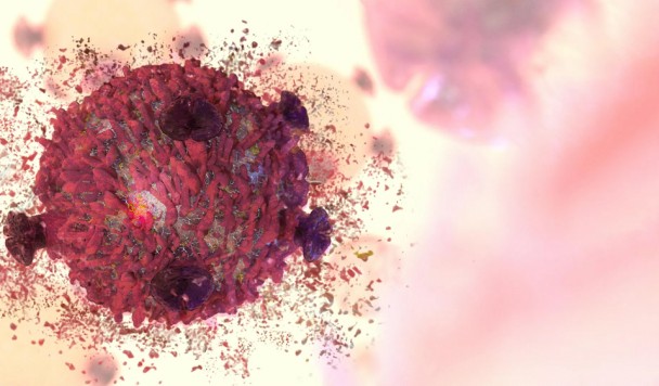 Разработаны наночастицы железа, уничтожающие опухоли изнутри